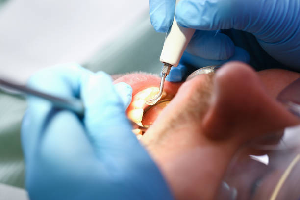 Best Holiday Emergency Dentist in New Baltimore, MI